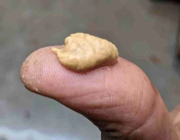 ಸಕ್ಕರೆ ಕಾಯಿಲೆಗೆ ಇದು ರಾಮಬಾಣ- ಖರ್ಚು ಇಲ್ಲದ ಚಿಕಿತ್ಸೆ.